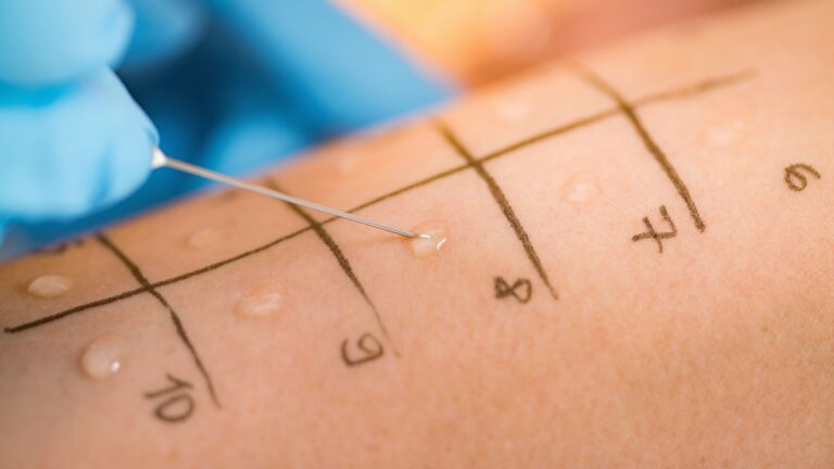 Allergy-Testing-in-Dubai-Allergy-Department-2