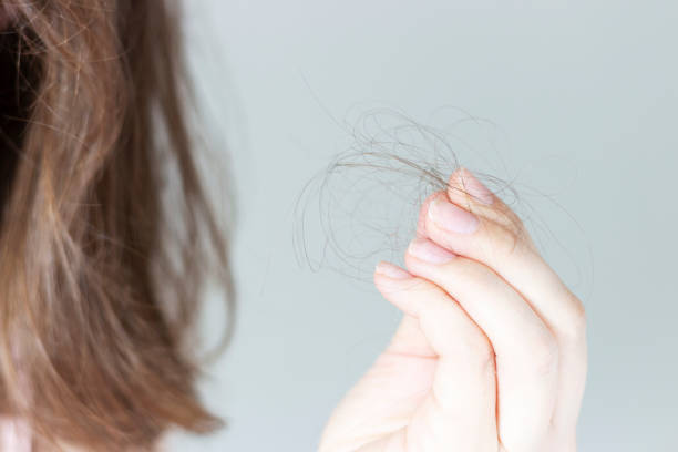 Are Hair Loss & Nail Disorders Permanent Issues