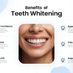 Teeth Whitening Treatment