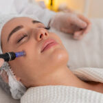 Can Dermapen Microneedling Minimize Large Pores
