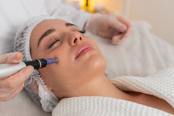 Can Dermapen Microneedling Minimize Large Pores
