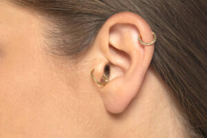Can Ear Piercing Help Avoid Skin Irritation