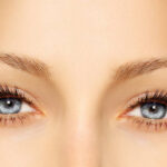 Can Eye Bag Removal Treat Stubborn Under-Eye Bags