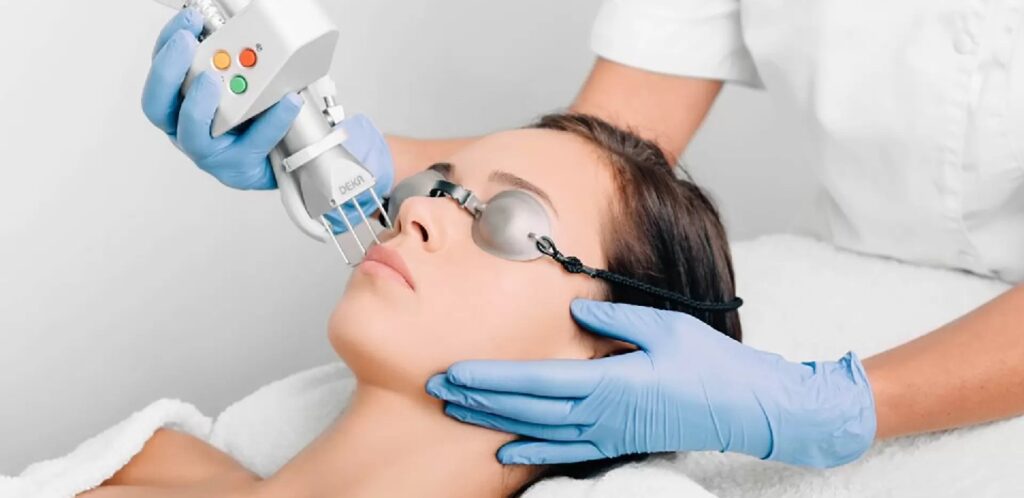 Can Pico Laser Treatment Reduce Stubborn Melasma