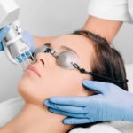 Can Pico Laser Treatment Reduce Stubborn Melasma