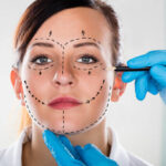 Do Facelifts Help Tighten Sagging Cheeks