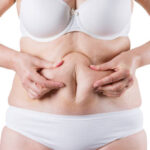 Does CoolSculpting Help With Double Chin Fat Reduction