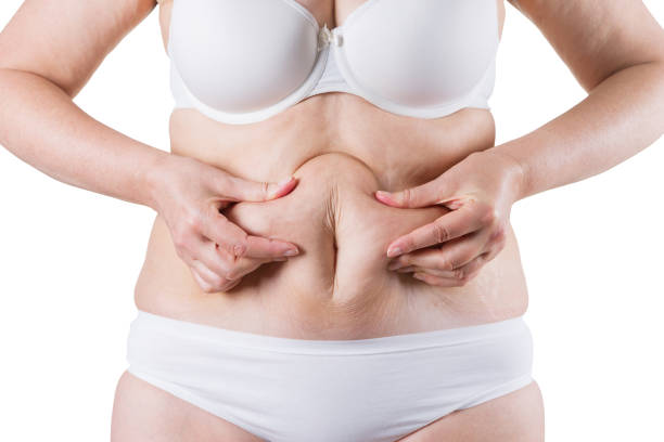 Does CoolSculpting Help With Double Chin Fat Reduction
