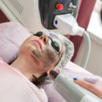 Does Laser Carbon Peel Shrink Large Pores