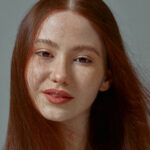 Does Melasma Treatment Help with Sun-Induced Spots