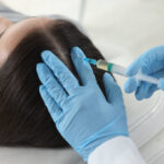 Does PRP Hair Treatment Reduce Shedding