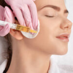 Does PRP Work for Treating Acne Scars