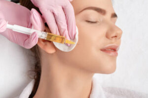 Does PRP Work for Treating Acne Scars