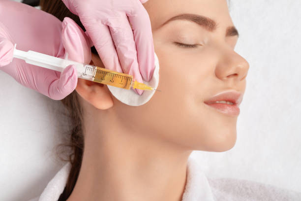 Does PRP Work for Treating Acne Scars