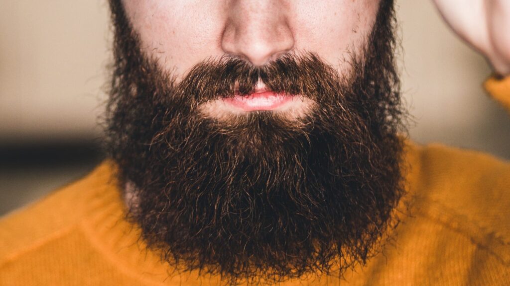 Does a Beard Transplant Last Forever on Your Face