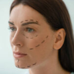 How Do Facelifts Reduce Wrinkles Fast