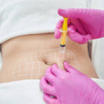 How Does Aqualyx Injection Dissolve Fat Safely