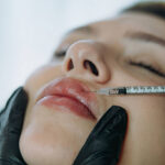 How Long Do Russian Lip Fillers Typically Last