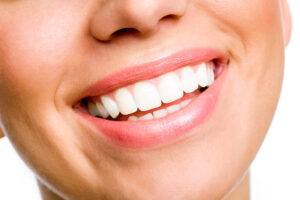 How Teeth Whitening Can Restore Natural Shine