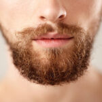 Is Beard Hair Transplant a Permanent Beard Solution