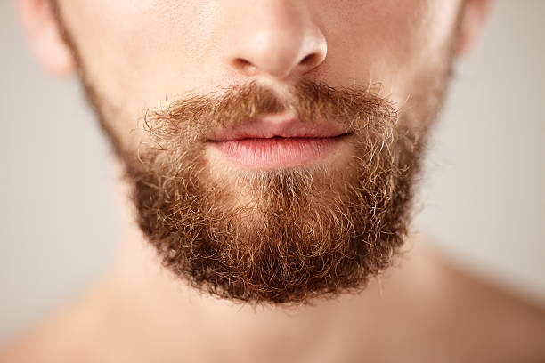 Is Beard Hair Transplant a Permanent Beard Solution
