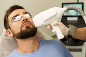Is Beard Laser Hair Removal Painful or Comfortable