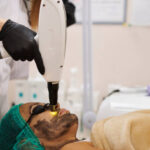Is Carbon Laser Better Than Traditional Skin Treatments