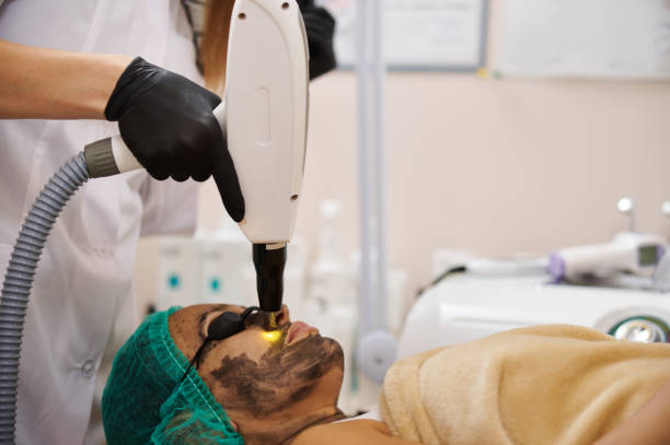 Is Carbon Laser Better Than Traditional Skin Treatments