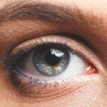 Is Eyelid Surgery Worth It for Eye Rejuvenation