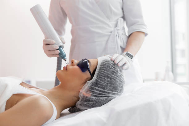 Is Pico Laser Effective for Tattoo Removal Without Scarring