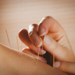 Acupuncture For Back Pain NYC/Grand Madison Acupuncture