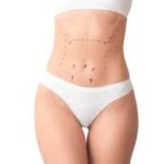 Mommy Makeover In Dubai