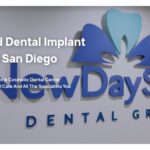 Dental Implant & Cosmetic dentist San Diego, CA | New Day Smile