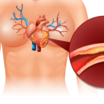 ct coronary angiography price