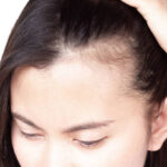 What Are the Benefits of Exosomes Hair Treatment