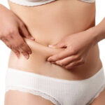What Areas Can CoolSculpting Treat Safely