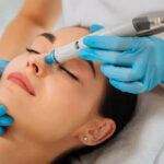 What HydraFacial Treatments Work Best for Acne