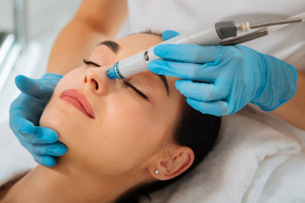 What HydraFacial Treatments Work Best for Acne