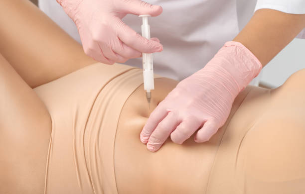 What Is the Ideal Age for Fat Melting Injections Treatment