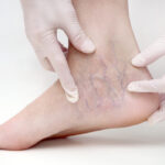 علاج تصليب في أبو ظبي