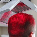 كم مرة يجب الخضوع لعلاج تساقط الشعر بالليزر؟