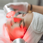 كم من الوقت يستغرق العلاج بضوء LED ليبدأ مفعوله؟