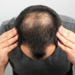 كيفية استخدام علاج الشعر بـ GFC بشكل صحيح؟