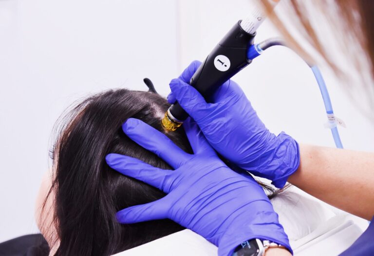 ما الذي يميز علاج تساقط الشعر بالليزر عن غيره؟