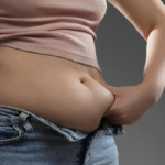 ما هي فترة النقاهة بعد جراحة ربط المعدة؟