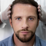 هل زراعة الشعر بدون ندوب مناسبة لجميع الأعمار؟
