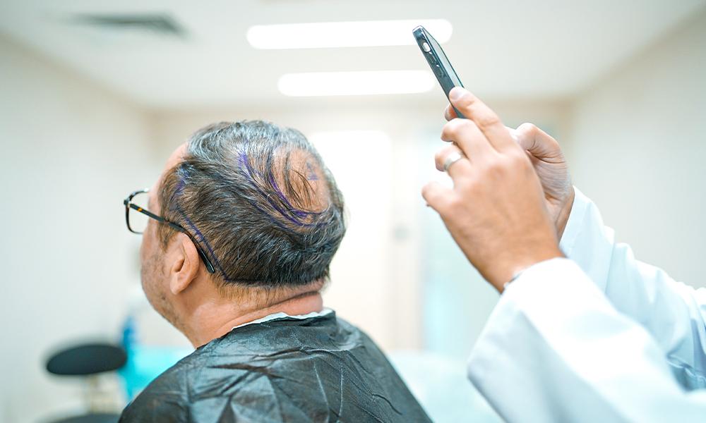 زراعة شعر التاج أبو ظبي