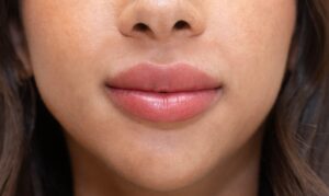 هل علاج شفاه المدخنين مناسب لجميع أنواع البشرة؟