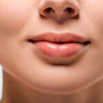 فيلر فولبيلا في أبو ظبي