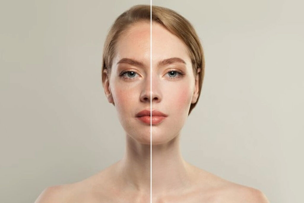 تصبغ الجلد أبو ظبي